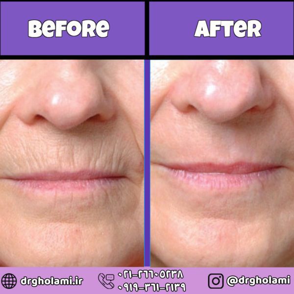 آیا بعد از اینکه گفتم آپنه انسدادی خواب بی‌فایده است، عجیب و غریب هستم؟