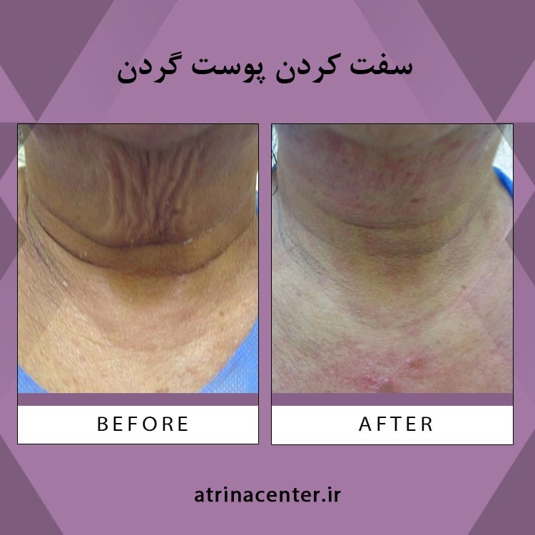 ۸ دلیل محکم برای جلوگیری از آپنه انسدادی خواب