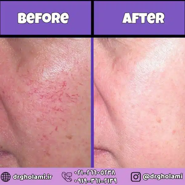 ۴ نکته که باید در مورد آپنه انسدادی خواب بدانید.