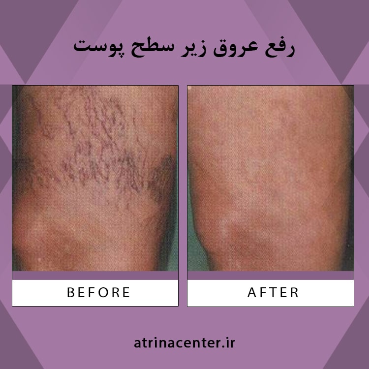 بررسی تکنیک‌های یادگیری آماری به عنوان کاربردی برای داده‌های ارزان آپنه انسدادی خواب کودکان (4).txt